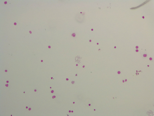 Male Chromosomes Slides - Male Chromosomes 01 40X